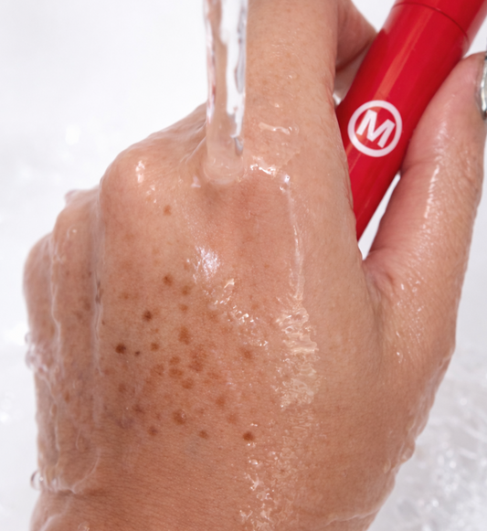 Why Your Freckle Pen Disappears (And How to Fix It)